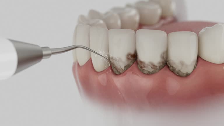 Reliable Tooth Extraction contractor in McMullen County County, TX by Dentist Open Now